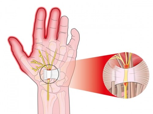 abu dhabi plastic surgery hand 1